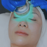 Ultra Cold Laser Facial